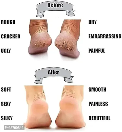Anti Crack Full Length Silicone Foot Protector Moisturizing Socks for Foot-Care and Heel Cracks,socks for cracked feet,heel pad for heel pain,anti crack heel socks-thumb2