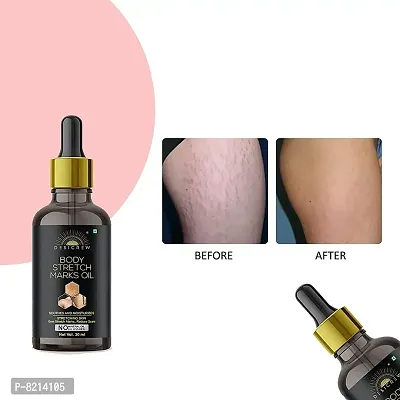 Desicrew Organic Body stretch mark removal Oil | Anti Aging | Pregnancy Stretch Mark Removal Oil| Scar Removal | Anti Wrinkle | Skin Hydration(30 ml)-thumb2