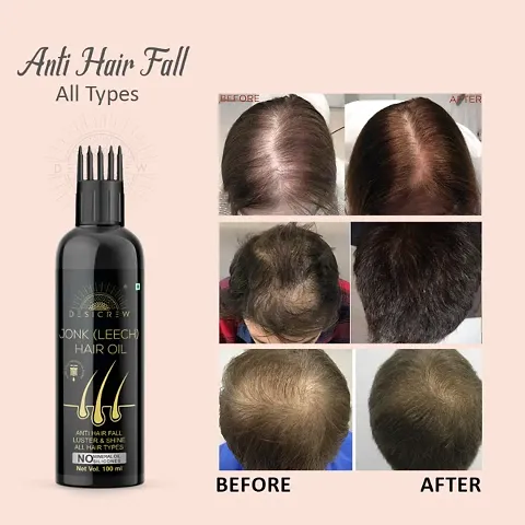 Natural Herbal Oil For Hair Growth