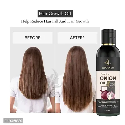 Ayurvedic Onion Oil for Controls Hair Fall ONION HAIR OIL (50ML) (PACK OF 1)-thumb0