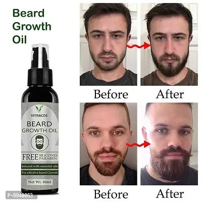 VitraCos Beard Growth Oil   Hair Oil   50 ml-thumb0