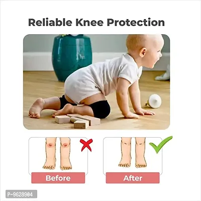 Baby Knee Pads for Crawling  AntiSlip Padded Stretchable Elastic Cotton Soft Breathable Comfortable Knee Cap Elbow Safety Protector Knee Protection For Baby Safe For Knee Soft To Wear Baby Set Orthopedic Knee Support (Random Color   pack of 2)-thumb3