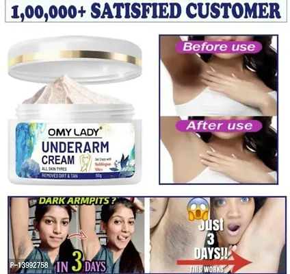 OMY LADY Advanced UndeR-Arm Whitening Cream (50 Gm)Pack of 1 Whitening Cream For Private Parts 7 Days To Remove Melanin Underarm Whitening Cream For Men  Women (50gm) Pack of 1