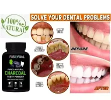 RISORIAL Teeth Whitening Powder 100gm-thumb1