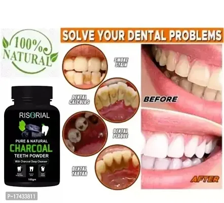 RISORIAL Teeth Whitening Powder 100gm-thumb2