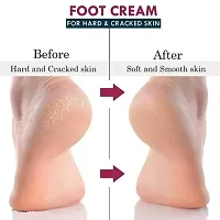 Avira Foot Crack Cream For Dry Cracked Heels  Feet 100% Guaranteed Man And Womanrsquo;s-50gm-thumb2