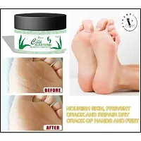 Avira Foot Crack Cream For Dry Cracked Heels  Feet 100% Guaranteed Man And Womanrsquo;s-50gm-thumb1