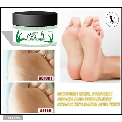 Avira Foot Crack Cream For Dry Cracked Heels  Feet 100% Guaranteed Man And Womanrsquo;s-50gm