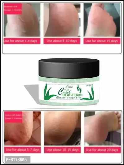 Avira Foot Crack Cream For Dry Cracked Heels  Feet 100% Guaranteed Man And Womanrsquo;s-50gm