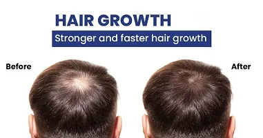 Nestreez Hair Science Hair Oil, Reduces Hair Fall and Grows New Hair, 100% Ayurvedic Oil, 100ml-thumb4