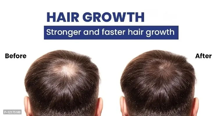Nestreez Hair Science Hair Oil, Reduces Hair Fall and Grows New Hair, 100% Ayurvedic Oil, 100ml-thumb5