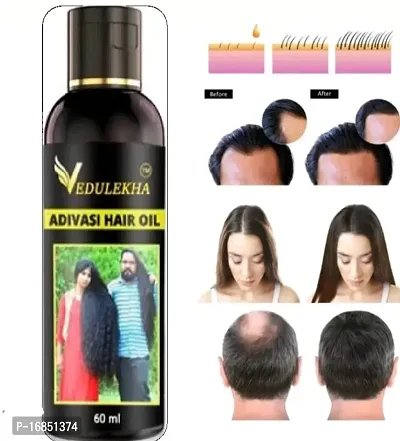 Adivasi Hair Oil- 60 ml for Women and Men for Shiny Hair Long - Dandruff Control - Hair Loss Control - Long Hair - Hair Regrowth Hair Oil with Goodness of Bhringraj and Loki, Oil Hair ( 100 % Ayurvedi-thumb3