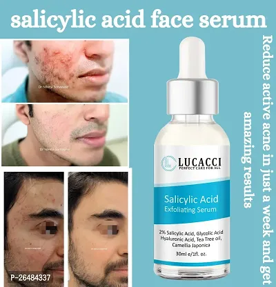 LUCACCI Brightening  Whitening Vitamin C Face Serum, hyaluronic acid for Anti pimple, Acne Free Skin, Aloe Vera extract for face Anti Ageing, Face Oil  Serum for Dry Skin and Oily Skin, Fairness  Face Glow | 30ml *1-thumb0