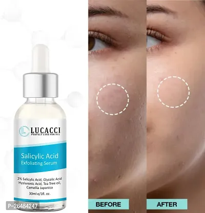 LUCACCI Brightening  Whitening Vitamin C Face Serum, hyaluronic acid for Anti pimple, Acne Free Skin, Aloe Vera extract for face Anti Ageing, Face Oil  Serum for Dry Skin and Oily Skin, Fairness  Face Glow | 30ml *1-thumb0