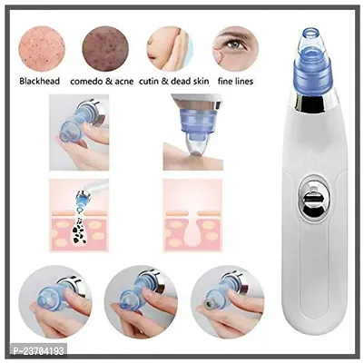 Blackhead Whitehead Extractor Remover Device Acne Pimple Pore Cleaner Vacuum Suction Tool for Men and Women. (Derma Suction 4 in 1)-thumb2