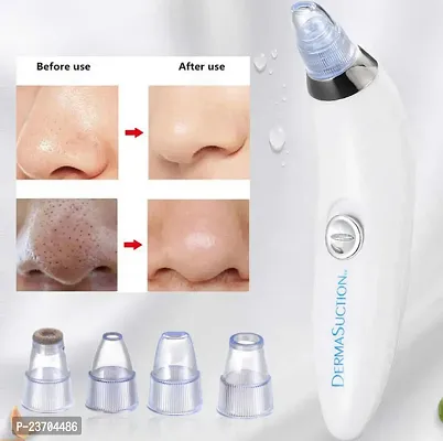 4 in 1 Blackhead Whitehead Extractor Remover Device Acne Pimple Pore Cleaner Vacuum Suction Tool for Men and Women.-thumb0