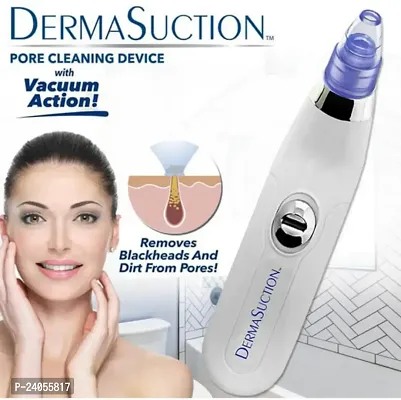 Blackhead Whitehead Extractor Remover Device Acne Pimple Pore Cleaner Vacuum Suction Tool for Men and Women. (Derma Suction 4 in 1)