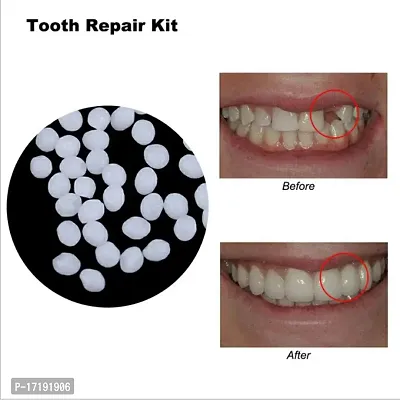 Tooth Repair Kit, Moldable False Teeth for Beautiful India