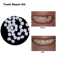 GAH Dental Thermal Beads Teeth Veneers Moldable Denture Temporary Tooth Repair 25g-thumb1