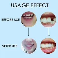 GAH Dental Thermal Beads Teeth Veneers Moldable Denture Temporary Tooth Repair 25g-thumb2