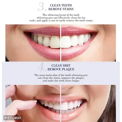 GAH 1 Pcs Teeth Pen Whitener Cleaning Bleaching Stains Remover-thumb2