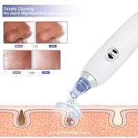 Derma Suction Blackhead Remover Vacuum Pimple Sucker Tool For Men And Women-thumb1