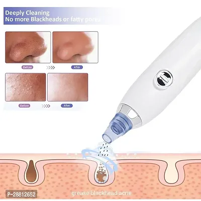 Derma Suction Blackhead Remover Vacuum Pimple Sucker Tool For Men And Women-thumb3