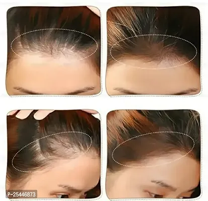 light brown Maybe lucky hairline pack of 1-thumb5