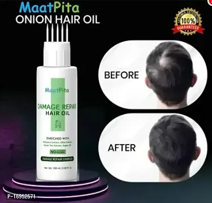 Essential Onion Oil For Hair Regrowth  Hair Fall Control Hair Oil-thumb0