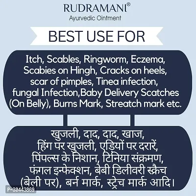 Ayurvedic Skin Care Fungal Infection Cream-thumb3