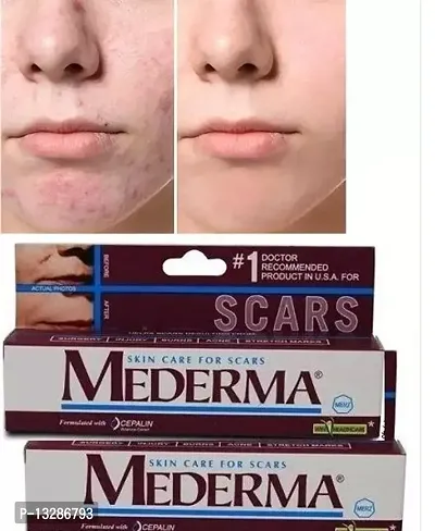 PROFESSIONAL MEDERMA SKIN CARE FOR SCARS WITH PACK OF 02