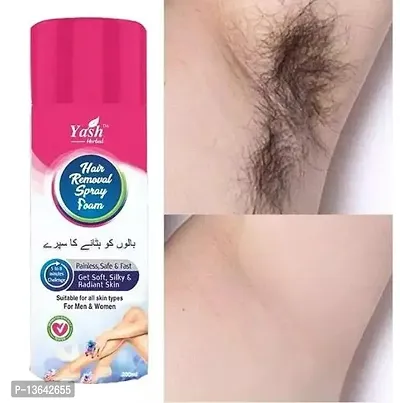 Women Hair Removal spray foom (200ml) pack of 1-thumb0