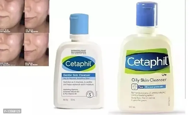 Cetaphil oily (125ml) + Cetaphil Gentle (125ml) pack of 2-thumb0