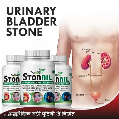 Stonnil Herbal Capsules For Helps To Remove Stone In Kidney 100% Ayurvedic (180 Capsules)