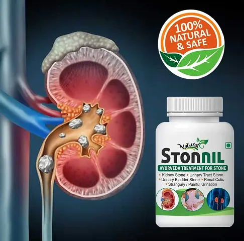 Stonnil Herbal Capsules For Helps To Remove Stone In Kidney