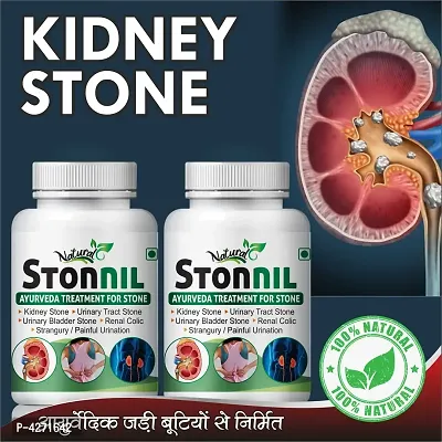 Stonnil Herbal Capsules For Helps To Remove Stone In Kidney 100% Ayurvedic (120 Capsules)