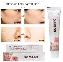 NO DAAG ANTI ACNE  FACE CARE NIGHT CREAM 20x2 GRM PACK OF 2-thumb3