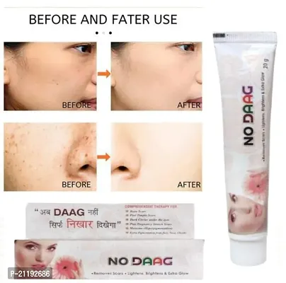 NO DAAG ANTI ACNE  FACE CARE NIGHT CREAM 20x2 GRM PACK OF 2-thumb4