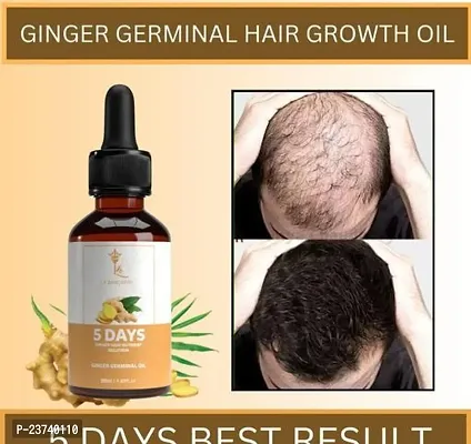 Organique Ginger Hair Oil For Healthy And Silky Hair | Redensyl |Onion hair oil for hair loss | Onion hair oil for dandruff | Hair growth Roller |Onion hair oil for strong and shiny hair | - 30ml(pack of 1)-thumb0