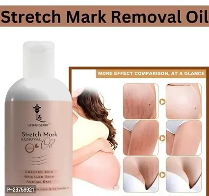 Repair Stretch Marks Removal - Natural Heal Pregnancy Breast, Hip, Legs, Mark Oil 100 Ml Pack Of 1-thumb0