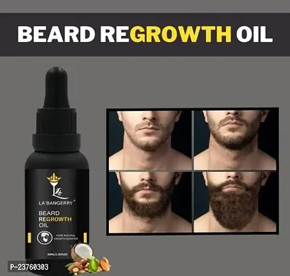 Beard Hair Growth Oil - Faster Beard Growth And Thicker Looking Beard 30Ml (Pack Of 1)