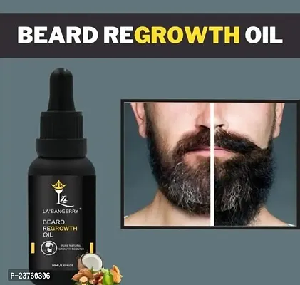 High Quality Beard Growth Oil - Advanced Beard Growth Oil For Men - Stimulate Beard Growth - Enriched With Vitamin E, Aloe Vera Oil, Coconut Oil, Almond Oil 30Ml (Pack Of 1)