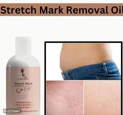 Repair Stretch Marks Removal - Natural Heal Pregnancy Breast, Hip, Legs, Mark Oil 100 Ml Pack Of 1-thumb0