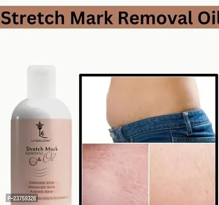 Stretch Marks Present Repair Stretch Marks Removal - Natural Heal Pregnancy Breast, Legs, Mark Oil 100 Ml Pack Of 1