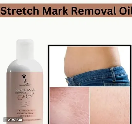 Repair Stretch Marks Removal - Natural Heal Pregnancy Breast, Hip, Legs, Mark Oil 100 Ml Pack Of 1