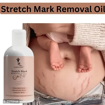 Repair Stretch Marks Removal - Natural Heal Pregnancy Breast, Hip, Legs, Mark Oil 100 Ml Pack Of 1