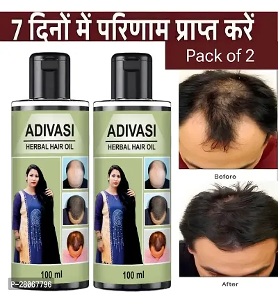 AdivasI  for Women and Men for Shiny Hair Long - Dandruff Control - Hair Loss Control - Long Hair - Hair Regrowth Hair Oil 100ML (Pack of 2)