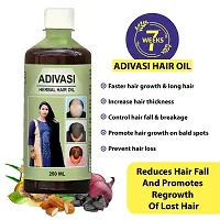 Dandruff Control Hair Loss Control Hair Oil 250ml (Pack of 1)-thumb2