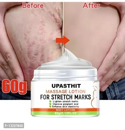 Pregnancy Stretch Marks Removal Cream 50gm