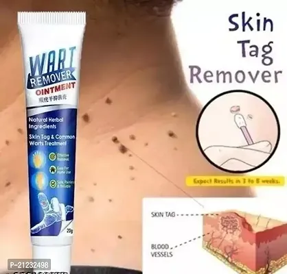Wart Remover Best 100gm Cream